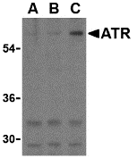 a01563 1 antxr1 primary antibodies wb testing 1