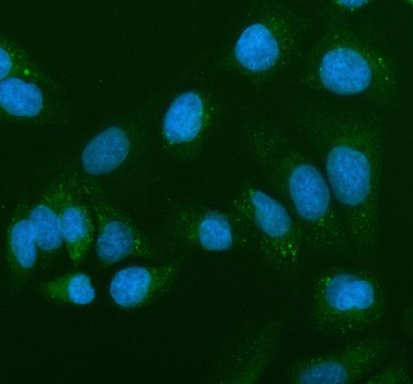 a01563 2 antxr1 primary antibodies if testing 1
