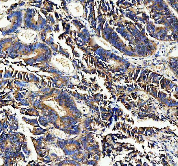 a01563 2 antxr1 primary antibodies ihc testing 1