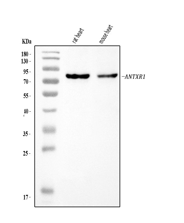  Western blot analysis of TEM8/ATR/ANTXR1 using anti-TEM8/ATR/ANTXR1 antibody (A01563-2)
