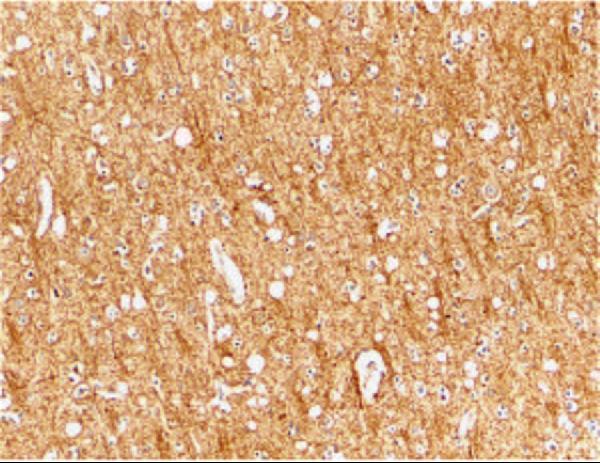a01563 antxr1 primary antibodies ihc testing 2