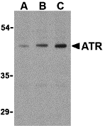a01563 antxr1 primary antibodies wb testing 1