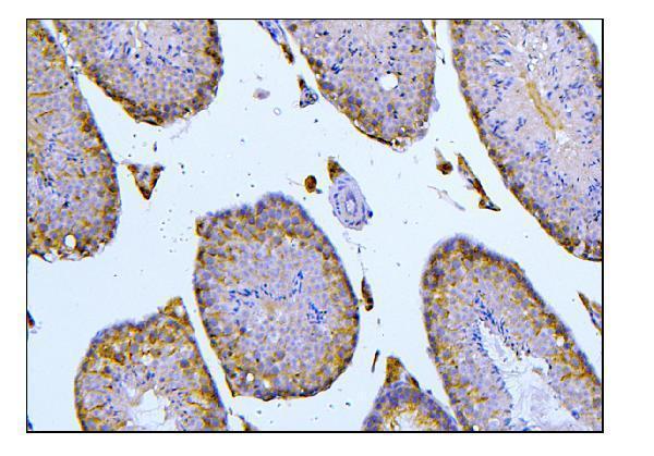  IHC analysis of BubR1/BUB1B using anti-BubR1/BUB1B antibody (A01564-1)