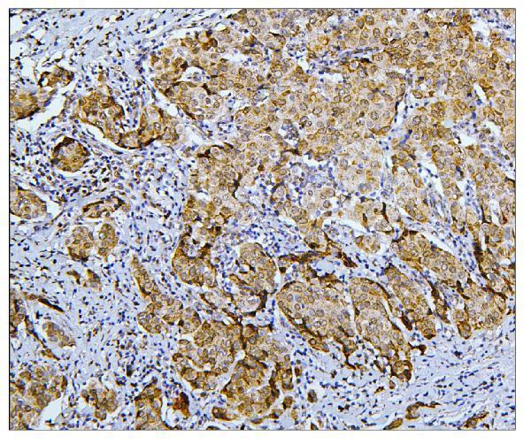 a01564 1 bub1b primary antibodies ihc testing 11
