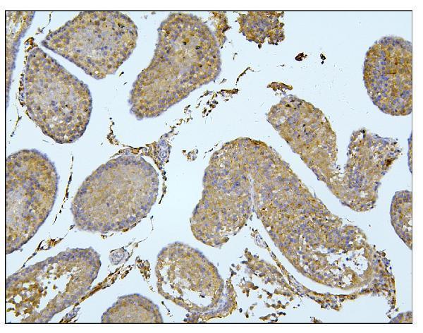 a01564 1 bub1b primary antibodies ihc testing 8