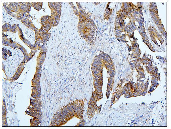 a01564 1 bub1b primary antibodies ihc testing 9