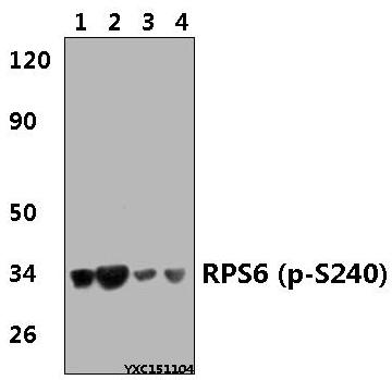 a01567s240 rps6 primary antiboties wb testing 1