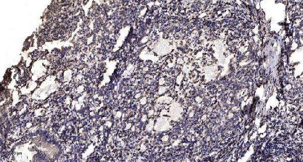 a01567s6s235 rps6 primary antibodies ihc testing 3