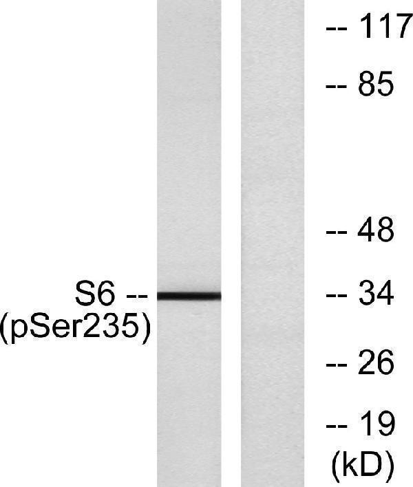 a01567s6s235 rps6 primary antibodies wb testing 2