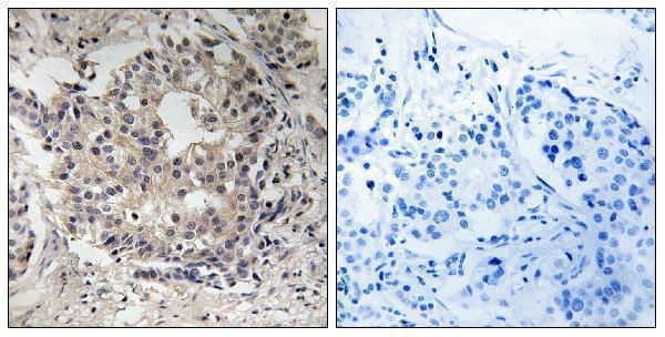 a01567s6s235s236 rps6 primary antibodies ihc testing 1