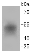 Western blot analysis of FosB on human liver lysates using anti-FosB antibody at 1/1,000 dilution