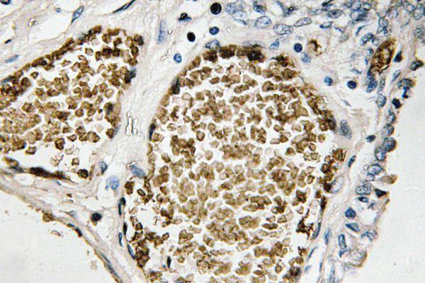 a01569s23 fosb primary antiboties ihc testing 2