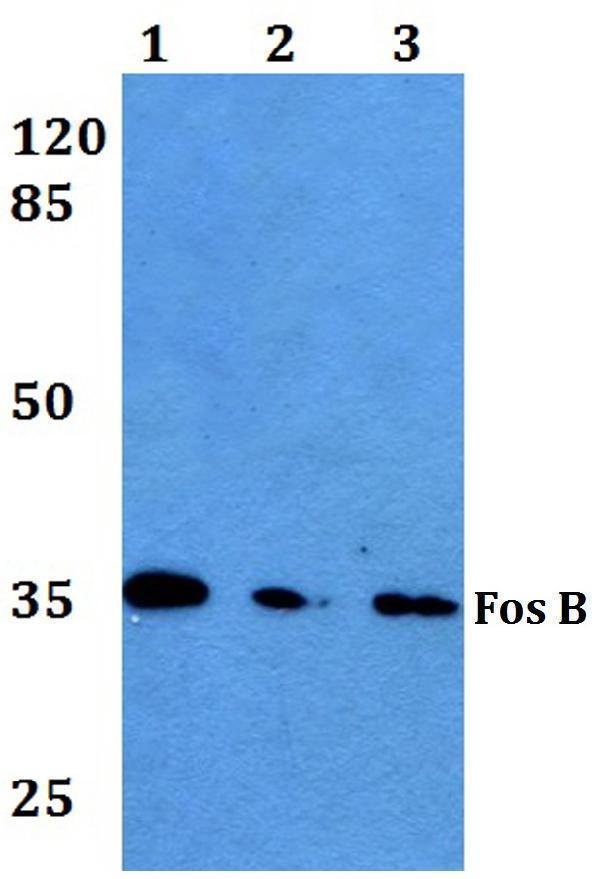 a01569s23 fosb primary antiboties wb testing 1