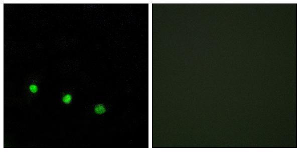 a01569s27 fosb primary antibodies if testing 1