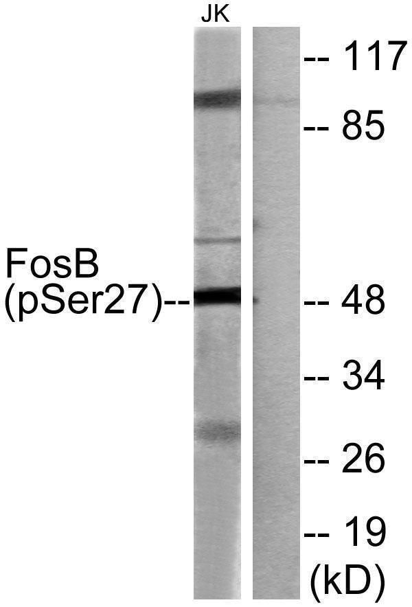 a01569s27 fosb primary antibodies wb testing 2