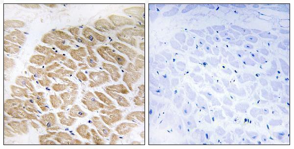 Immunohistochemistry analysis of paraffin-embedded human heart tissue, using MIA Antibody