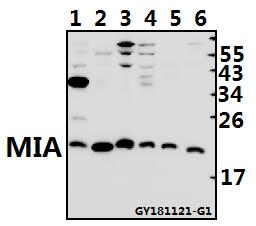 a01570 mia primary antiboties wb testing 1
