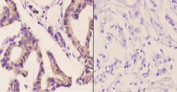 a01571y85 aifm1 primary antiboties ihc testing 2