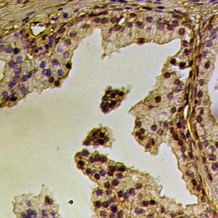 Immunohistochemistry (IHC) analyzes of Caveolin-2 (phospho-Y19) polyclonal antibody in paraffin-embedded human prostate tissue at 1:50