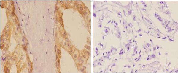 a01575s726 add1 primary antiboties ihc testing 2