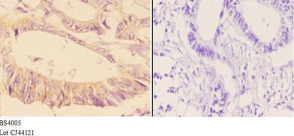a01575s726 add1 primary antiboties ihc testing 3