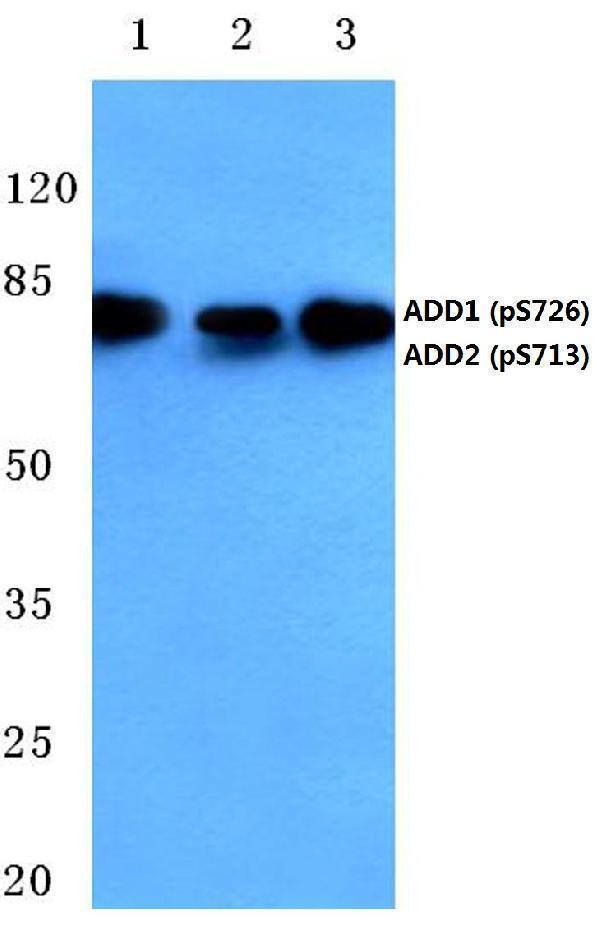 a01575s726 add1 primary antiboties wb testing 1