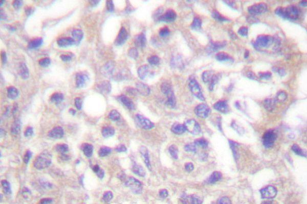 a01575t445 add1 primary antiboties ihc testing 2