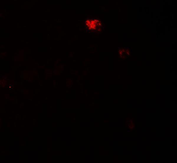 a01576 ppm1d primary antibodies if testing 3