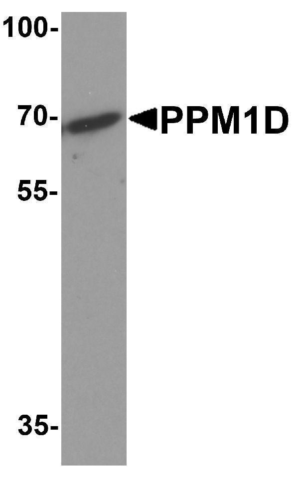 a01576 ppm1d primary antibodies wb testing 1