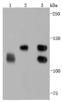 Western blot analysis of N Cadherin on different lysates using anti-N Cadherin antibody at 1/1,000 dilution