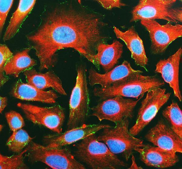 a01577 3 cdh2 primary antibodies if testing 1