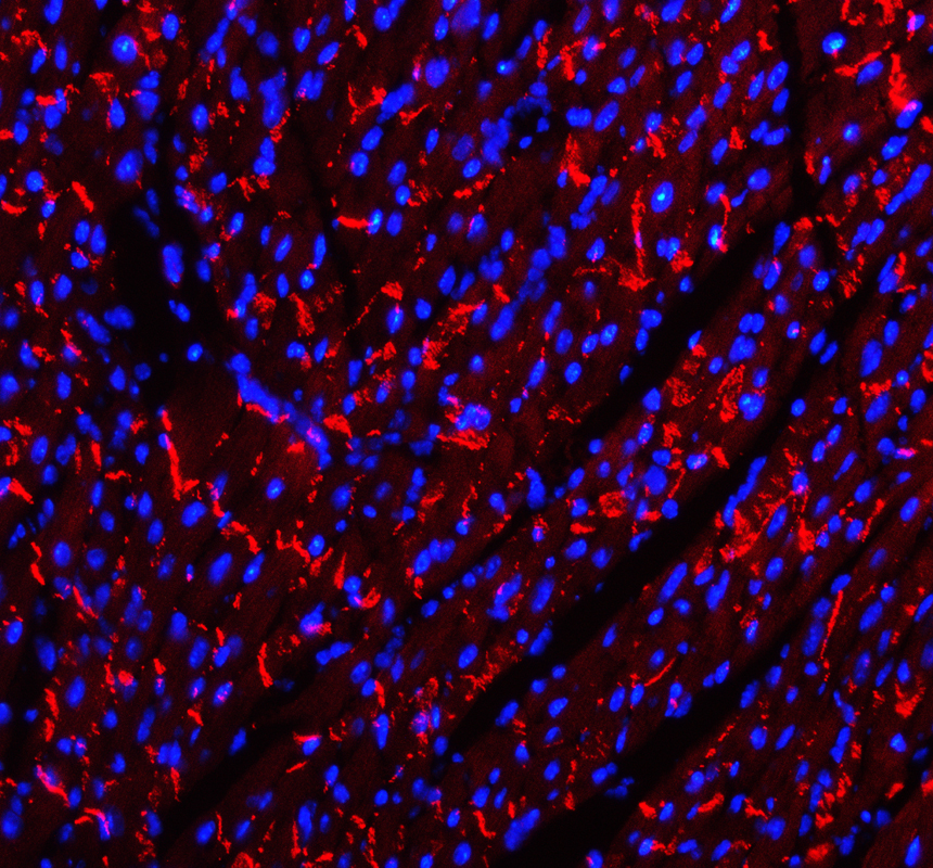 a01577 3 cdh2 primary antibodies if testing 3