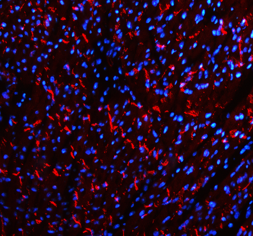 a01577 3 cdh2 primary antibodies if testing 4