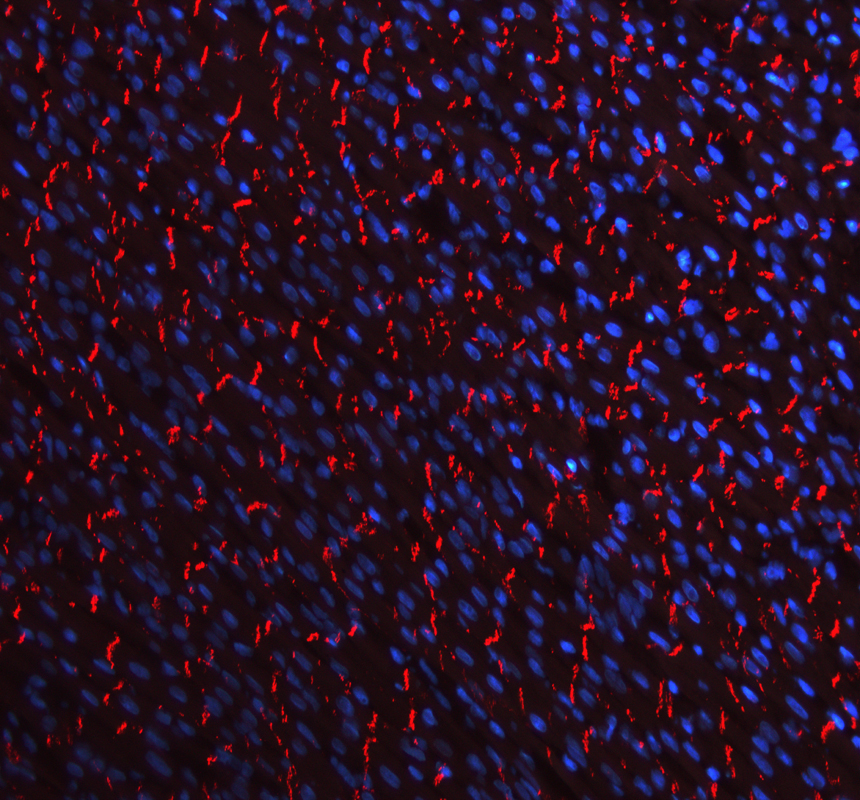 a01577 3 cdh2 primary antibodies if testing 5