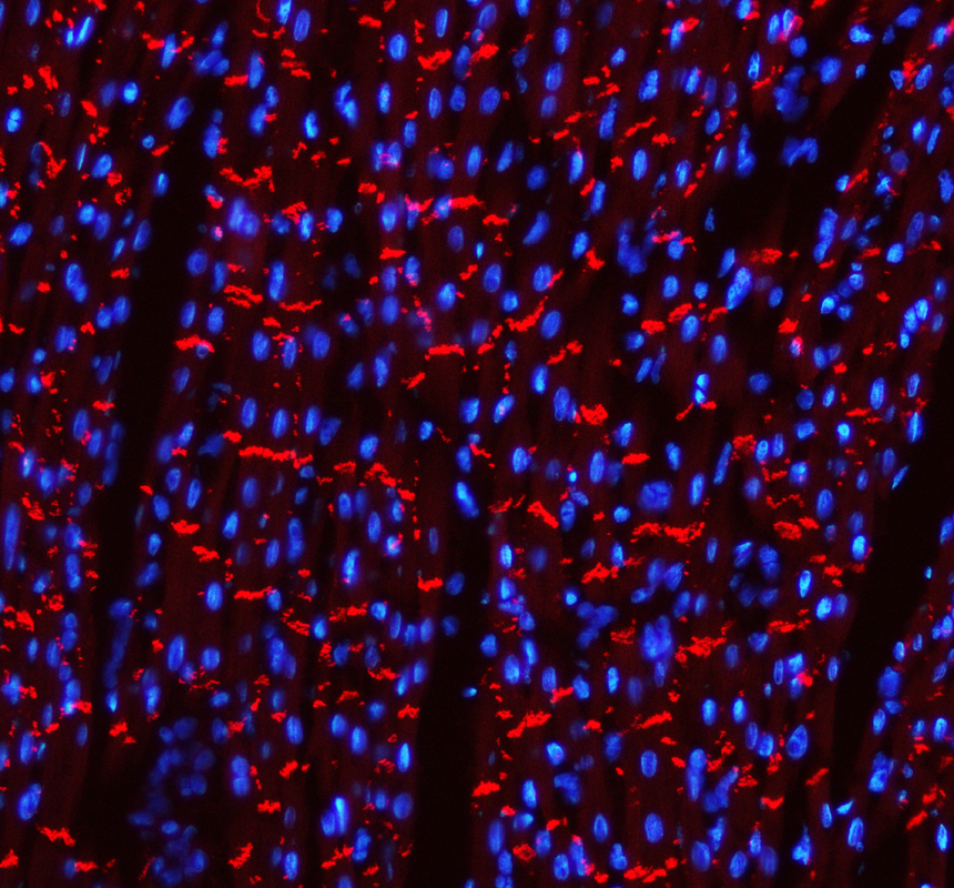 a01577 3 cdh2 primary antibodies if testing 7