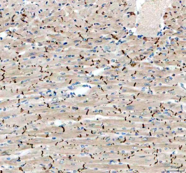 a01577 3 cdh2 primary antibodies ihc testing 1