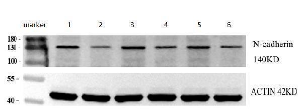 a01577 3 cdh2 primary antibodies wb review 1