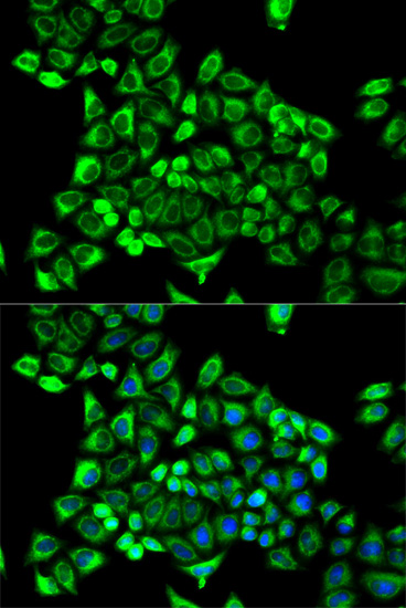 a01578 cda primary antiboties if testing 3