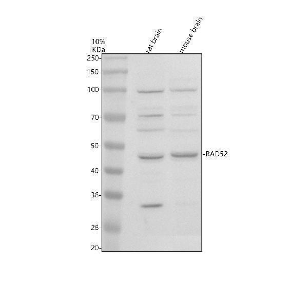 Western blot analysis of RAD52 using anti-RAD52 antibody (A01580-4)
