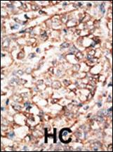 a01581 anti bmpr1a antibody c term ihc p testing 3