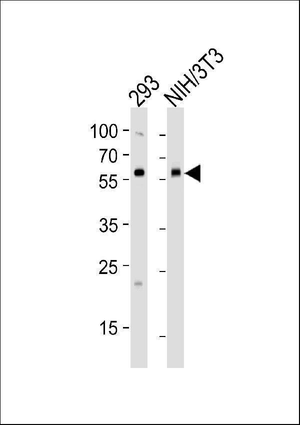 a01581 anti bmpr1a antibody c term wb testing 1