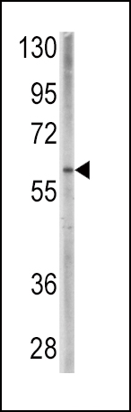 a01581 anti bmpr1a antibody c term wb testing 2