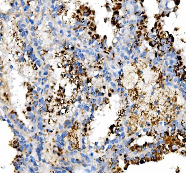 a01582 2 npc2 primary antibodies ihc testing 1