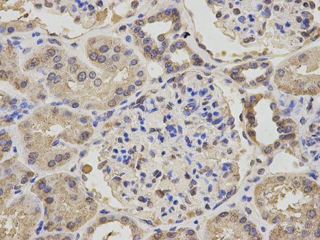 a01582 npc2 primary antiboties ihc testing 2