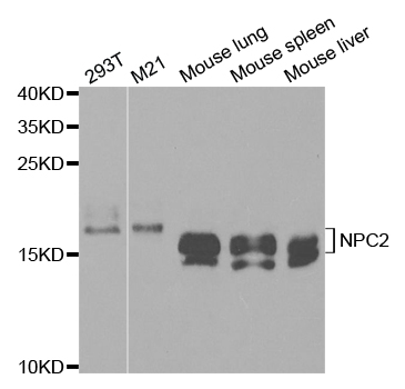 a01582 npc2 primary antiboties wb testing 1