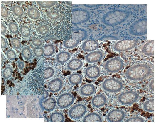 a01583 3 gdf15 primary antibodies ihc testing 3_1