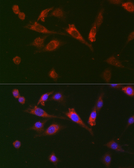 Immunofluorescence analysis of BALB-3T3 cells using GDF15 Rabbit pAb  at dilution of 1:100 