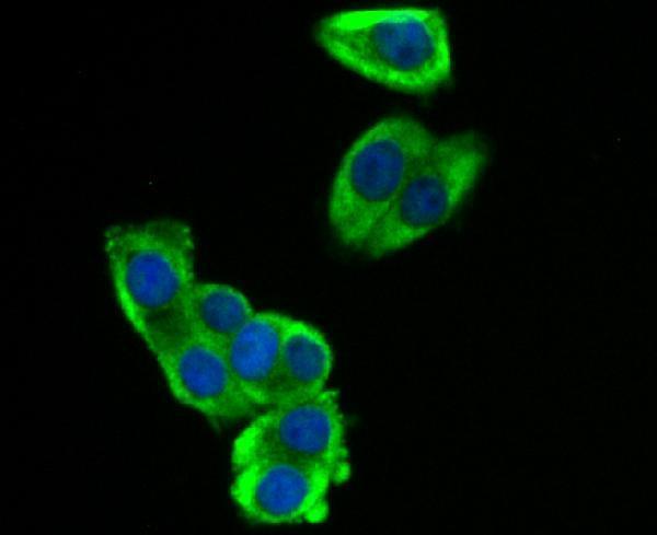 a01584 socs2 primary antiboties icc testing 2