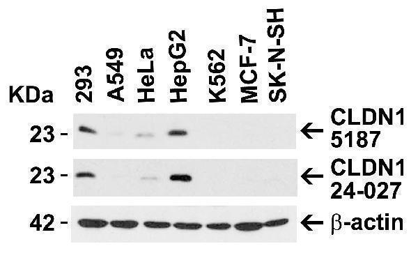 Independent Antibody Validation (IAV) via Protein Expression Profile in Human Cell Lines
Loading: 15 μg of lysates per lane
