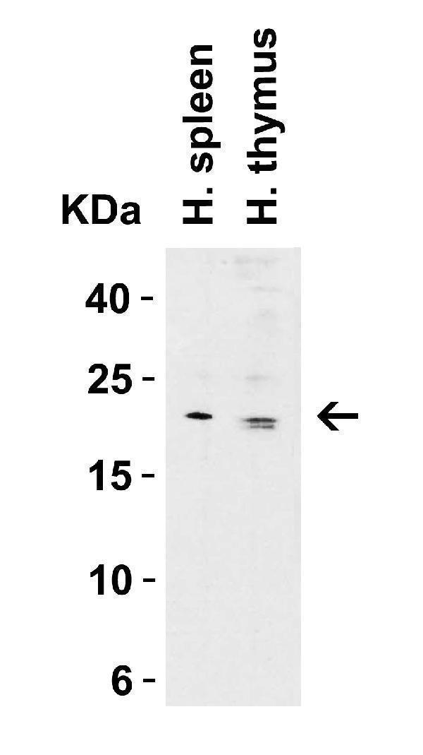 Western Blot Validation in Human Tissue Lysates
Loading: 15 μg of lysates per lane